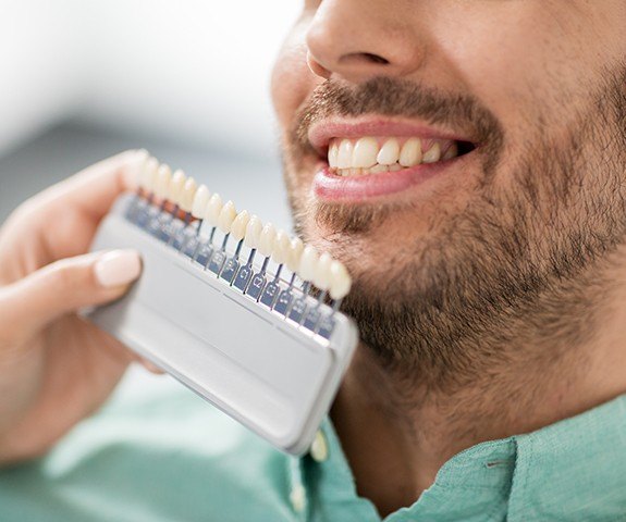 Closeup of smile compared with porcelain veneer shade chart